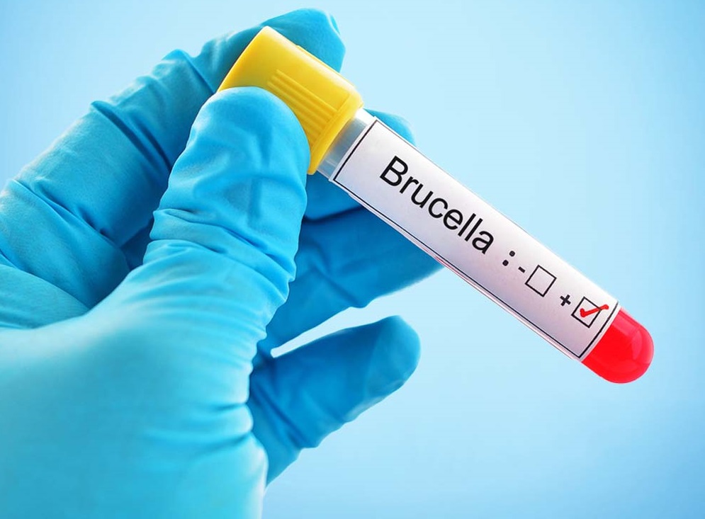 ما حقيقة الإصابات بالحمى المالطية؟